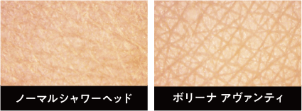 肌比較